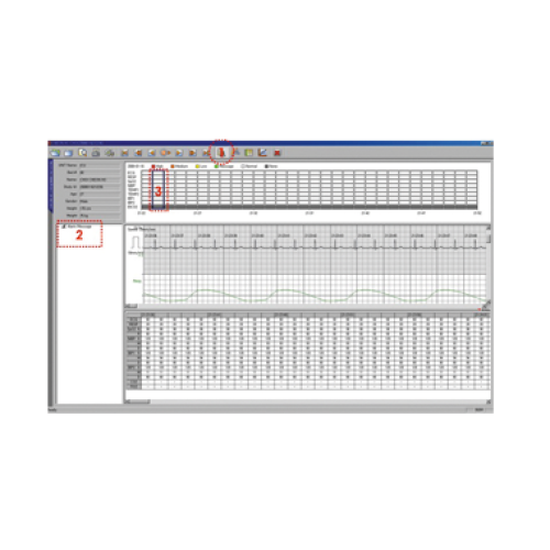 Sistem de monitorizare centrala a pacientilor